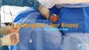 Transjugular Liver Biopsy